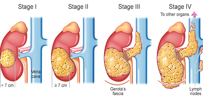 Best Doctor For Kidney Problems in Mulund